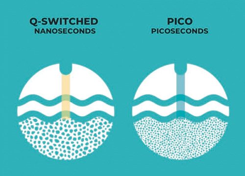 NANOSEGUNDOS-VS-PICOSEGUNDOS